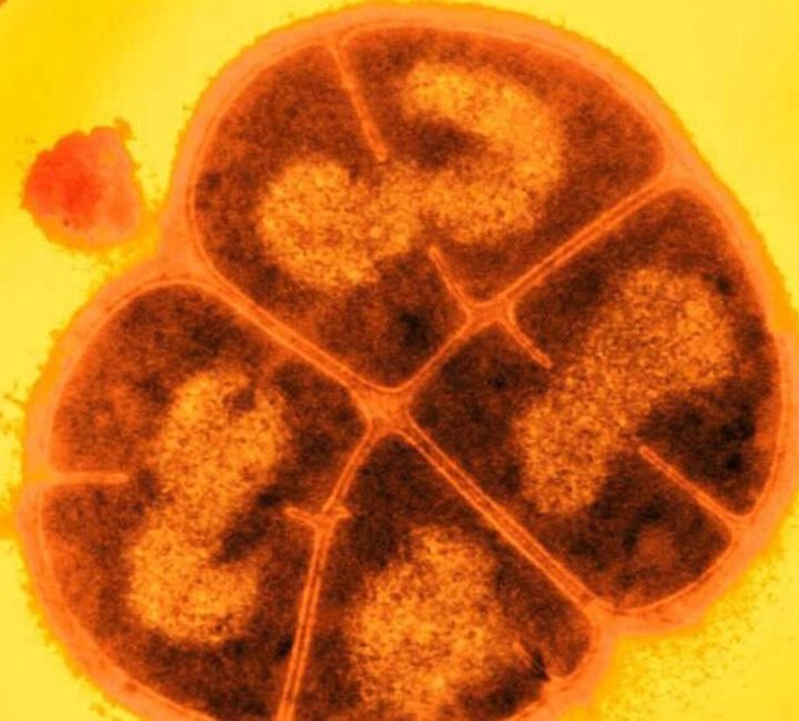 This Superbacteria can Withstand Enough Radiation to Kill a Person