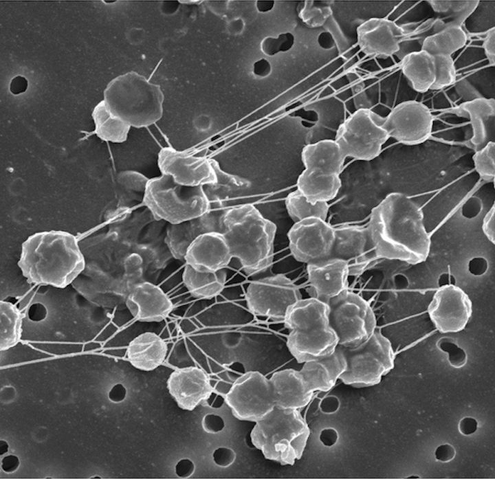 Could There Be Bacteria Living on Mars Today?