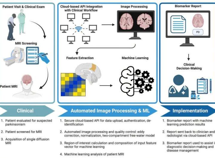 AI-driven software is 96% accurate at diagnosing Parkinson’s