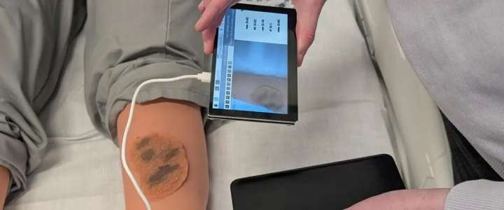 Researcher harnesses AI to transform skin cancer diagnosis in remote areas