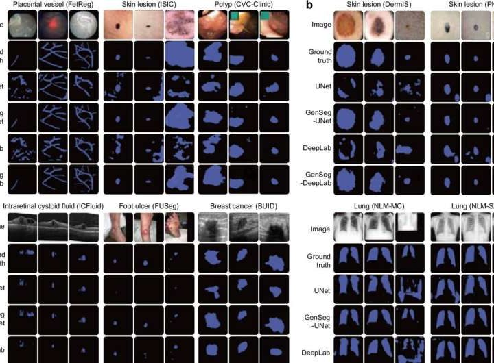 New AI tool learns to read medical images with far less data