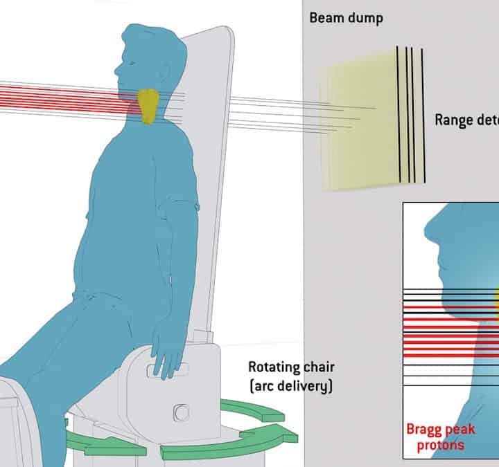 Optimizing upright proton therapy: hybrid delivery provides faster, sharper treatments