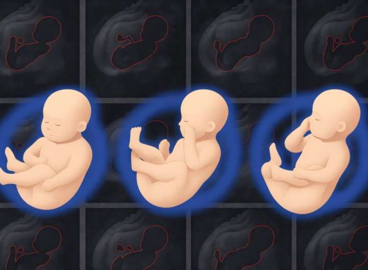 Machine-learning tool gives doctors a more detailed 3D picture of fetal health