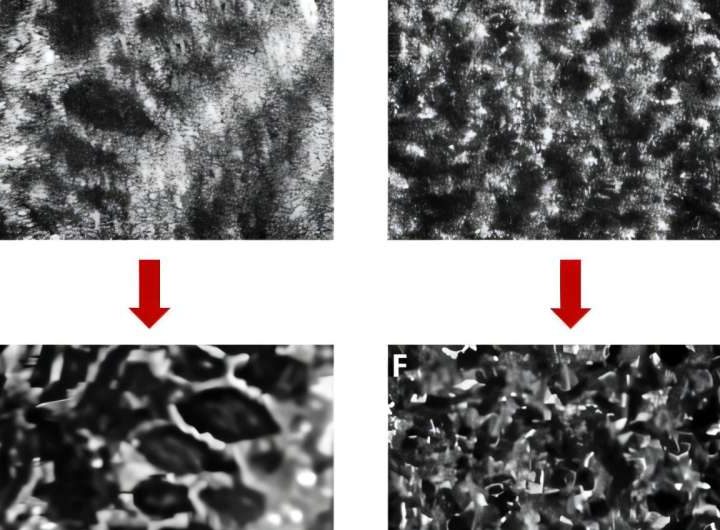 Bringing eye images into focus with AI