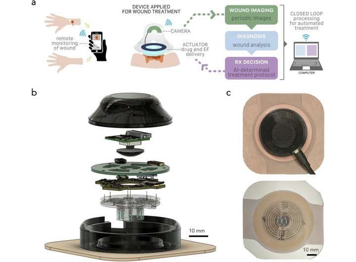 Smart device uses AI and bioelectronics to speed up wound healing process