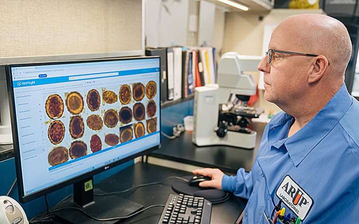 AI tool beats humans at detecting parasites in stool samples