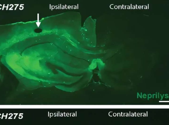 Discovery about brain receptors may open the door to new Alzheimer’s treatments