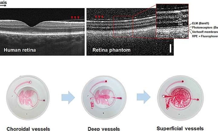 Scientists create artificial retina phantom to standardize eye disease diagnosis equipment