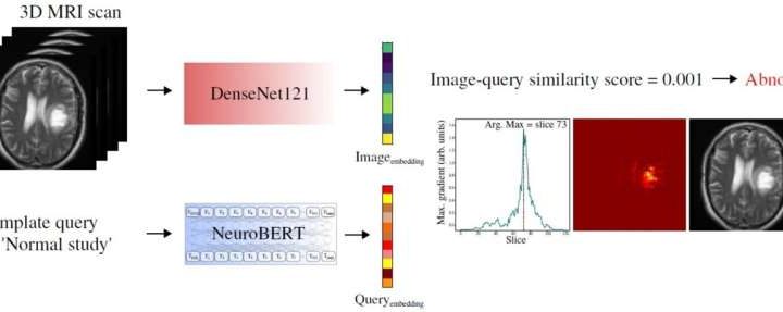 AI brain scan model identifies stroke, brain tumors and aneurysms