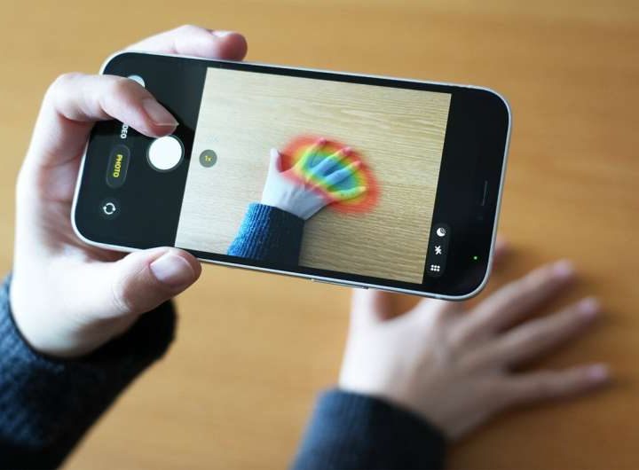 AI accurately spots medical disorder from privacy-conscious hand images