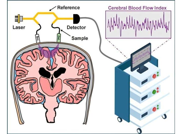 Next-gen interferometric diffusing wave spectroscopy achieves 20x signal boost in cerebral blood flow monitoring