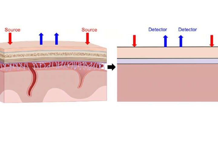 A layered approach sharpens brain signals in optical imaging