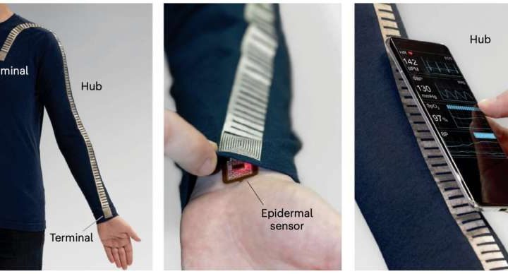 Battery-free textile turns clothing into a real-time blood pressure monitor